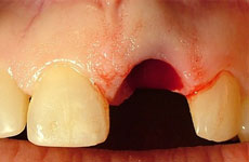 teeth before